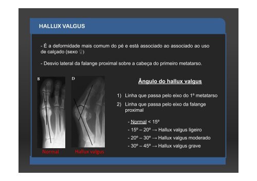 ESTUDOS MÉTRICOS EM RADIOLOGIA CONVENCIONAL ...