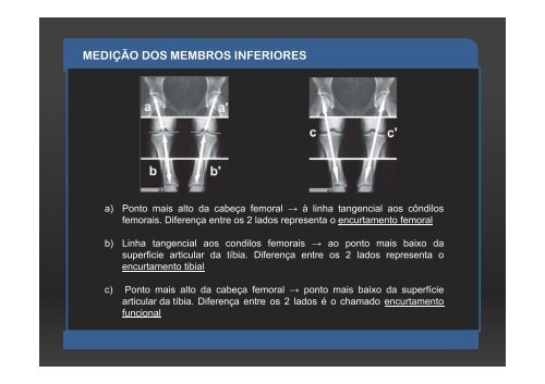 ESTUDOS MÉTRICOS EM RADIOLOGIA CONVENCIONAL ...