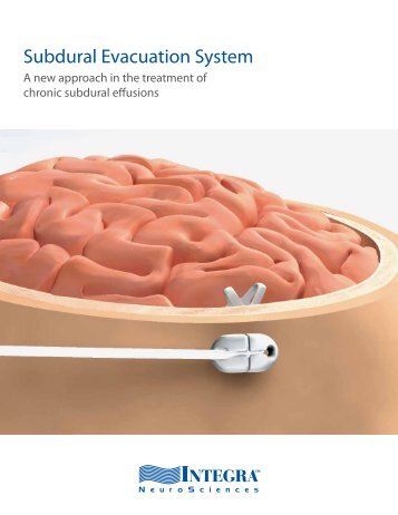 Subdural Evacuation System - Integra LifeSciences