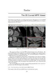 osirix free per mac
