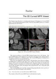 3D Curved MPR - OsiriX