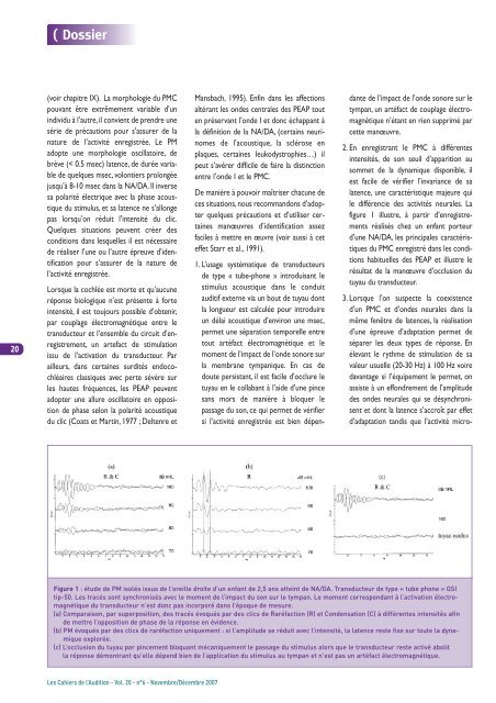 la neuropathie auditive / dÃ©synchronisation auditive - CollÃ¨ge ...