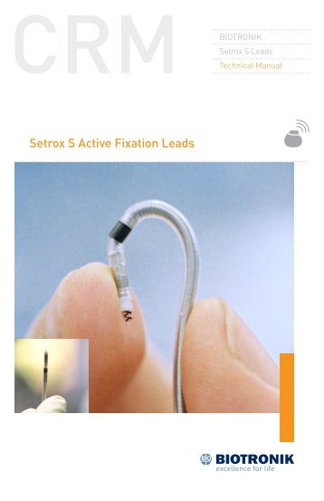 Setrox S Active Fixation Leads - BIOTRONIK USA - News