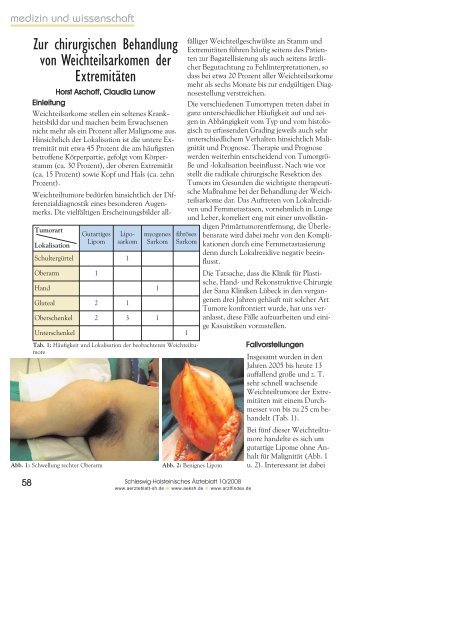 Zur chirurgischen Behandlung von Weichteilsarkomen der ...