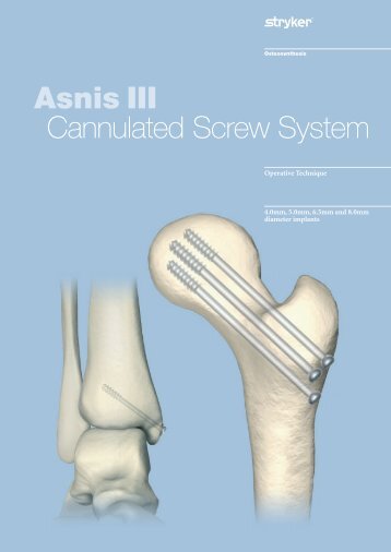 Asnis III Cannulated Screw System - Osteosyntese