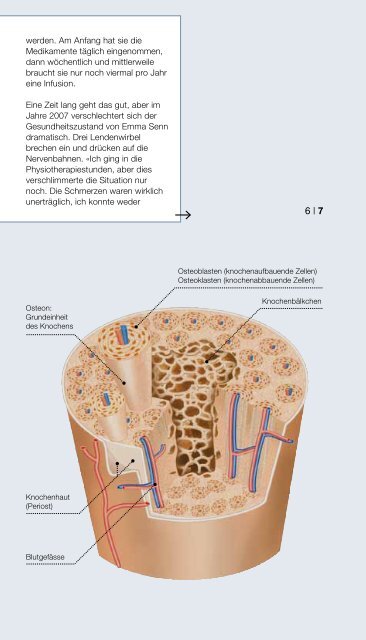Osteoporose: Wer frühzeitig handelt, kann das Risiko ... - Interpharma