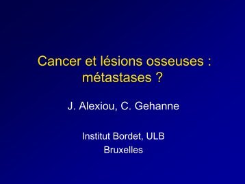 Cancer et lÃ©sions osseuses : mÃ©tastases ?