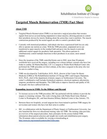 Targeted Muscle Reinnervation (TMR) Fact Sheet - Well-Tech