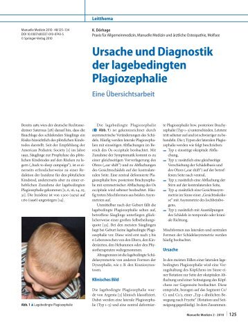 Ursache und Diagnostik der lagebedingten Plagiozephalie - Springer