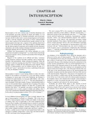 CHAPTER 68 Intussusception - Global HELP