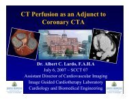 CT Perfusion as an Adjunct to Coronary CTA