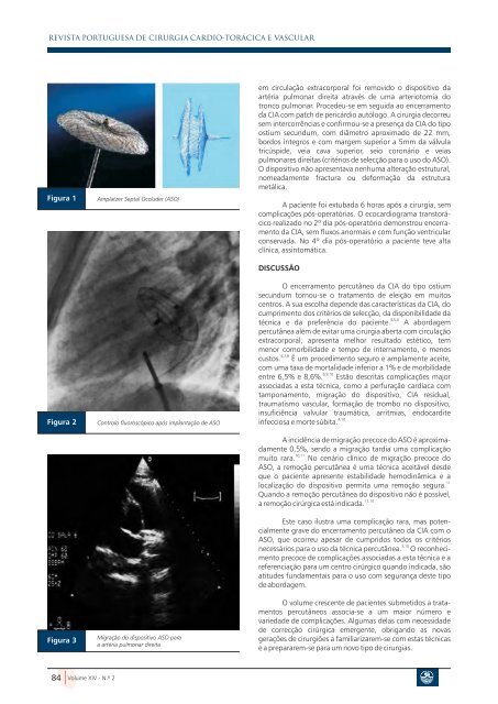 Resumo Summary - Sociedade Portuguesa de Cirurgia Cardio ...