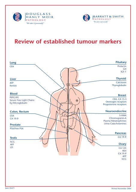 Review of established tumour markers