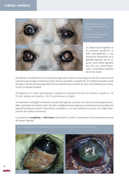 Endoscopia de vías respiratorias Afecciones ... - AMVAC