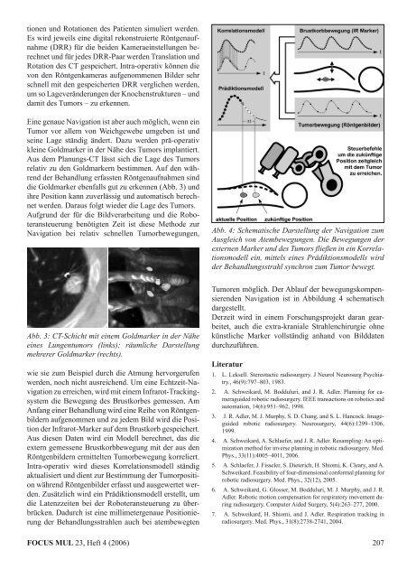 Thema "Navigation und Medizin" - Universität zu Lübeck