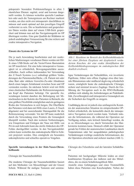 Thema "Navigation und Medizin" - Universität zu Lübeck