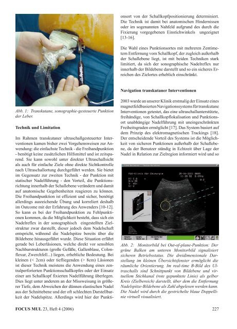 Thema "Navigation und Medizin" - Universität zu Lübeck