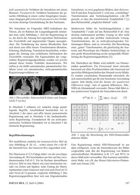 Thema "Navigation und Medizin" - Universität zu Lübeck