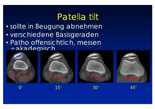 Radiologische Diagnostik des ... - Vinzenz Gruppe