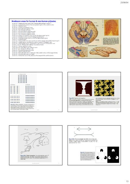 The occipital The occipital lobes Occipital lobe - Mahidol University