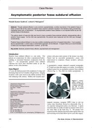 Asymptomatic posterior fossa subdural effusion - Pan Arab ...