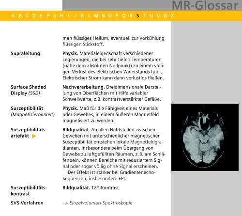 MR-Glossar