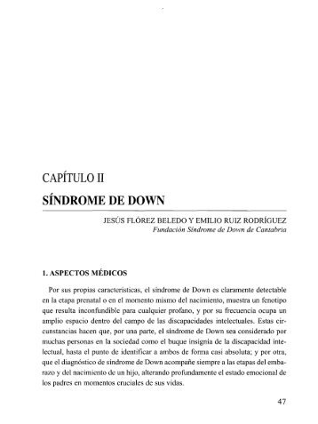 Síndrome de Down. - Feaps