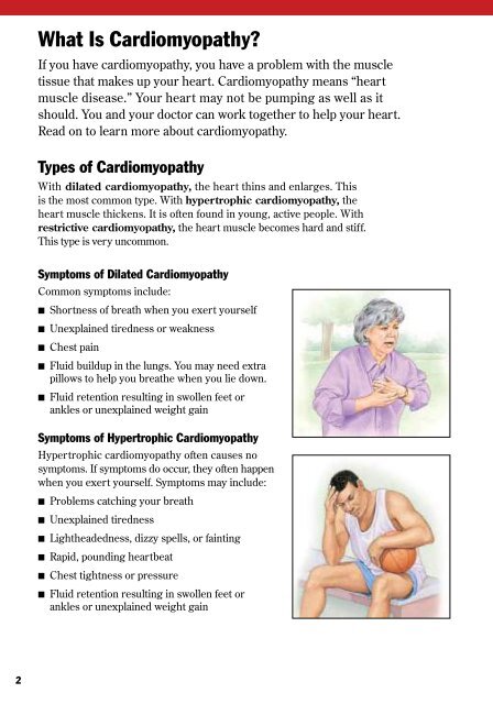 Understanding Cardiomyopathy - Veterans Health Library