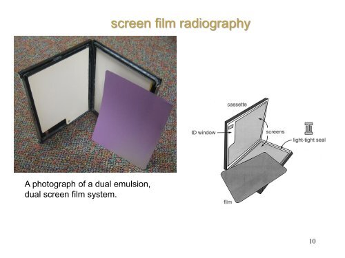 Projection Radiography