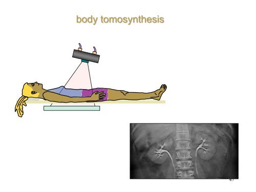 Projection Radiography