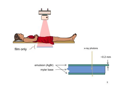 Projection Radiography