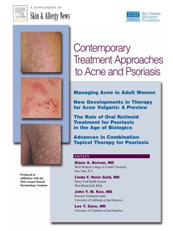 Contemporary Treatment Approaches to Acne and Psoriasis