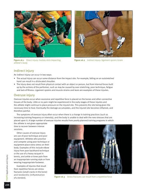 Ways to classify sports injuries