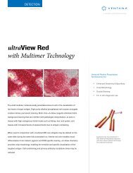 ultraView Red with Multimer Technology - Roche