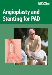 Angioplasty and Stenting for PAD - Veterans Health Library