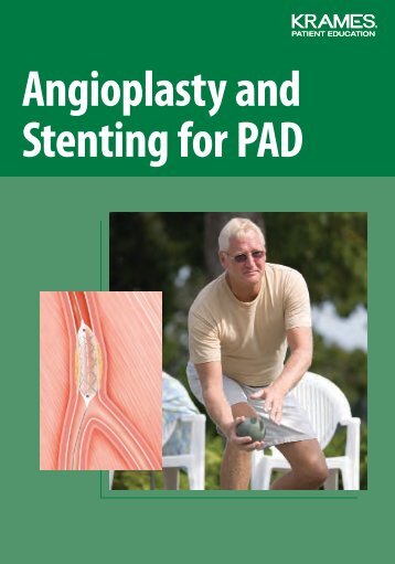 Angioplasty and Stenting for PAD - Veterans Health Library