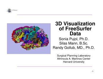 3D Visualization of FreeSurfer Data - 3D Slicer