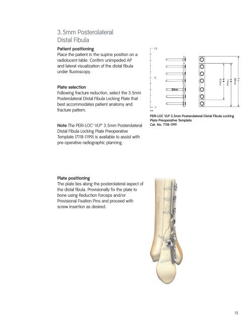 PeriLoc VLP Technique.pdf - Bonerepmedical.com