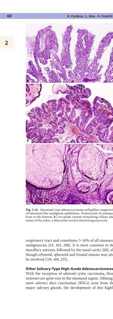 Pathology of the Head and Neck