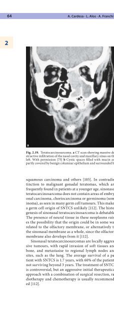 Pathology of the Head and Neck