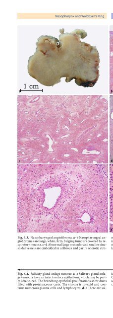 Pathology of the Head and Neck