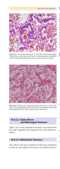 Pathology of the Head and Neck