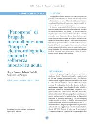 âFenomenoâ di Brugada intermittente - Giornale Italiano di ...