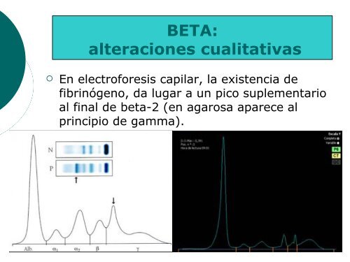 Trazado electroforÃ©tico - hgucr