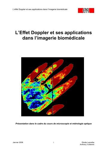 Effet Doppler : - LOB - EPFL