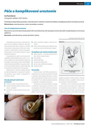 Péče o komplikované urostomie - Urologie pro praxi