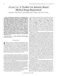 elastix: A Toolbox for Intensity-Based Medical Image Registration