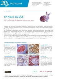 SP-Klone bei DCS - DCS - Innovative Diagnostik-Systeme