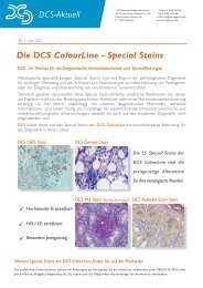 Die DCS ColourLine - DCS - Innovative Diagnostik-Systeme