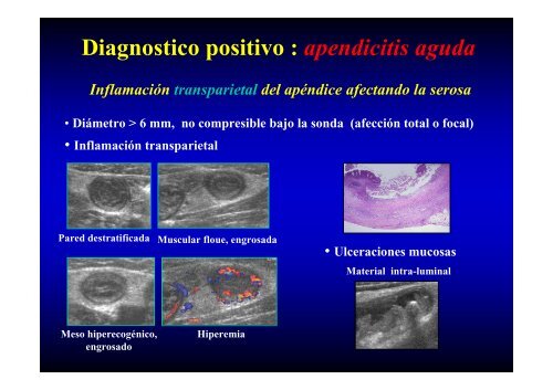 ABDOMEN AGUDO LO QUE SE DEBE Y NO SE DEBE HACER